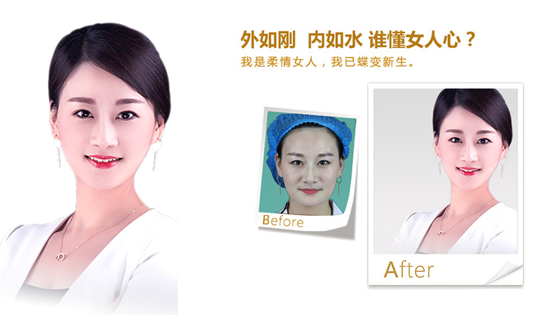 江津V脸、线雕隆鼻